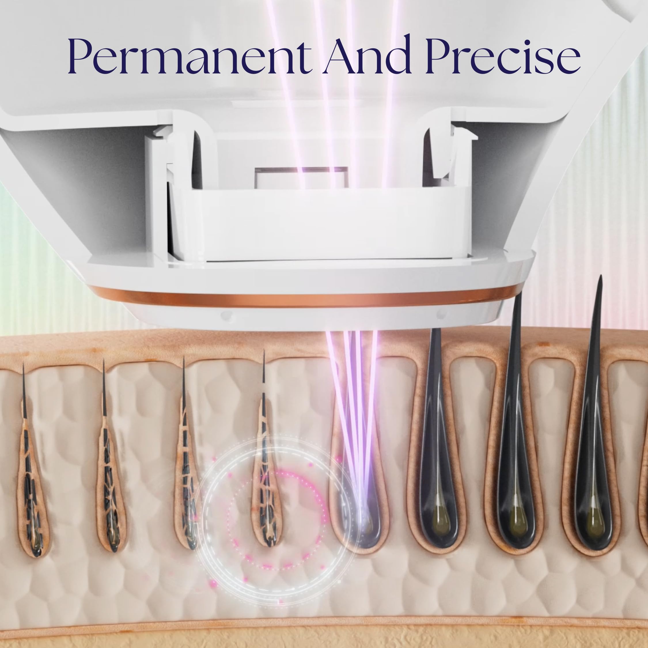 Epilaser Dark Skin At-Home Laser Hair Removal, Safe - Won’t Cause Skin Bleaching, Hypopigmentation | Intelligent, Clinical Strength, Painless Permanent Hair Removal for Face, Body, Bikini Line