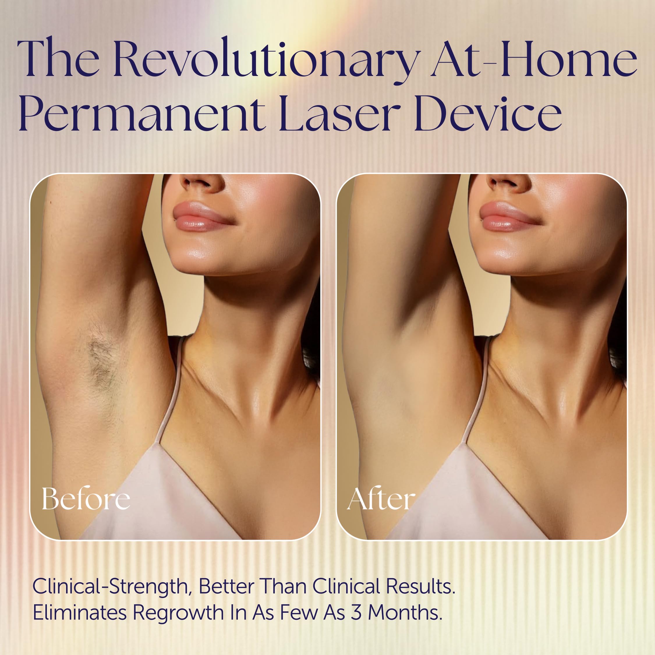 At-Home True Laser Hair Removal for Women, Face, Body & Bikini, Light Skin
